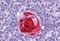 SWI/SNF Related, Matrix Associated, Actin Dependent Regulator Of Chromatin, Subfamily A, Member 4 antibody, MBS246309, MyBioSource, Immunohistochemistry paraffin image 