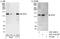 Zinc Fingers And Homeoboxes 3 antibody, A301-409A, Bethyl Labs, Immunoprecipitation image 
