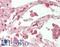 Golgin A1 antibody, LS-B13085, Lifespan Biosciences, Immunohistochemistry paraffin image 