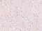 Cell Death Inducing DFFA Like Effector A antibody, 2085, ProSci, Immunohistochemistry frozen image 