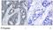 Insulin Receptor Substrate 1 antibody, GTX79037, GeneTex, Immunohistochemistry paraffin image 