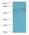 Interleukin 27 Receptor Subunit Alpha antibody, LS-C377940, Lifespan Biosciences, Western Blot image 