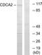 Cell Division Cycle Associated 2 antibody, GTX87138, GeneTex, Western Blot image 