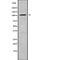 HECT Domain And Ankyrin Repeat Containing E3 Ubiquitin Protein Ligase 1 antibody, abx215810, Abbexa, Western Blot image 