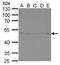 Tubulin Gamma 1 antibody, NBP2-43585, Novus Biologicals, Western Blot image 