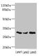 NADH:Ubiquinone Oxidoreductase Core Subunit S3 antibody, LS-C676137, Lifespan Biosciences, Western Blot image 