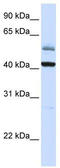 Armadillo Repeat Containing X-Linked 1 antibody, TA342022, Origene, Western Blot image 