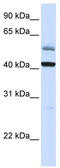 Armadillo Repeat Containing X-Linked 1 antibody, TA342022, Origene, Western Blot image 