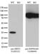 Sirtuin 5 antibody, NBP2-01003, Novus Biologicals, Western Blot image 