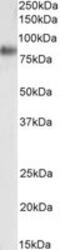 Scavenger Receptor Class B Member 1 antibody, MBS423420, MyBioSource, Western Blot image 