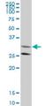 Geranylgeranyl Diphosphate Synthase 1 antibody, H00009453-M08, Novus Biologicals, Western Blot image 