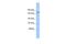 Pleckstrin Homology, MyTH4 And FERM Domain Containing H2 antibody, A13076, Boster Biological Technology, Western Blot image 