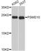 Proteasome 26S Subunit, Non-ATPase 10 antibody, abx127019, Abbexa, Western Blot image 