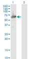 Methylcrotonoyl-CoA Carboxylase 2 antibody, H00064087-M05, Novus Biologicals, Western Blot image 