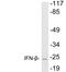 Interferon Beta 1 antibody, LS-C199895, Lifespan Biosciences, Western Blot image 