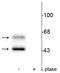 Calcium/Calmodulin Dependent Protein Kinase II Alpha antibody, P03241, Boster Biological Technology, Western Blot image 
