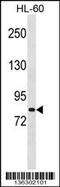 MutS Homolog 5 antibody, 58-814, ProSci, Western Blot image 
