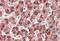Cytochrome P450 Family 2 Subfamily E Member 1 antibody, NBP1-52087, Novus Biologicals, Immunohistochemistry paraffin image 