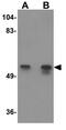 Karyopherin Subunit Alpha 2 antibody, GTX31812, GeneTex, Western Blot image 