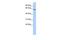 Potassium Voltage-Gated Channel Modifier Subfamily G Member 4 antibody, GTX47625, GeneTex, Western Blot image 