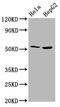 Threonine Synthase Like 2 antibody, CSB-PA803155LA01HU, Cusabio, Western Blot image 