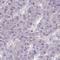 Zinc Finger Protein 581 antibody, HPA059657, Atlas Antibodies, Immunohistochemistry paraffin image 