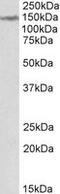 Lemur Tyrosine Kinase 2 antibody, MBS422474, MyBioSource, Western Blot image 