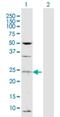 TATA-Box Binding Protein Associated Factor 13 antibody, H00006884-D01P, Novus Biologicals, Western Blot image 