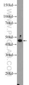 Four-Jointed Box Kinase 1 antibody, 17417-1-AP, Proteintech Group, Western Blot image 