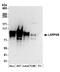 La Ribonucleoprotein Domain Family Member 4B antibody, A304-623A, Bethyl Labs, Western Blot image 