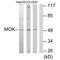 MOK Protein Kinase antibody, A01004, Boster Biological Technology, Western Blot image 