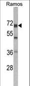 DEAD-Box Helicase 5 antibody, LS-C100666, Lifespan Biosciences, Western Blot image 