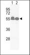 Activin A Receptor Like Type 1 antibody, PA5-14922, Invitrogen Antibodies, Western Blot image 