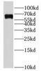 IKAROS Family Zinc Finger 3 antibody, FNab04207, FineTest, Western Blot image 