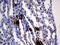 Interleukin-24 antibody, M03793-1, Boster Biological Technology, Immunohistochemistry paraffin image 
