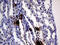 Interleukin 24 antibody, M03793-1, Boster Biological Technology, Immunohistochemistry paraffin image 