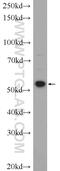 Zinc Finger Protein 277 antibody, 25094-1-AP, Proteintech Group, Western Blot image 