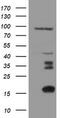 Migration And Invasion Enhancer 1 antibody, M07379-1, Boster Biological Technology, Western Blot image 