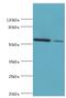 Adenylosuccinate Lyase antibody, LS-C375160, Lifespan Biosciences, Western Blot image 