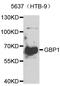 Guanylate Binding Protein 1 antibody, A6911, ABclonal Technology, Western Blot image 