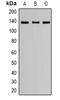 NPHS1 Adhesion Molecule, Nephrin antibody, orb382445, Biorbyt, Western Blot image 