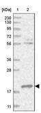 DCMP Deaminase antibody, PA5-57451, Invitrogen Antibodies, Western Blot image 