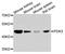 Pyruvate Dehydrogenase Kinase 3 antibody, MBS9128229, MyBioSource, Western Blot image 
