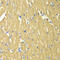 Tropomyosin alpha-3 chain antibody, 15-067, ProSci, Immunohistochemistry paraffin image 
