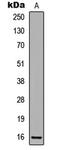 Cyclin-dependent kinase inhibitor 2A, isoforms 1/2/3 antibody, GTX32378, GeneTex, Western Blot image 
