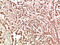 Protein Tyrosine Kinase 2 antibody, STJ98940, St John