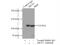 ATP-binding cassette sub-family F member 1 antibody, 13950-1-AP, Proteintech Group, Immunoprecipitation image 