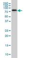 Slingshot Protein Phosphatase 3 antibody, H00054961-M01, Novus Biologicals, Western Blot image 