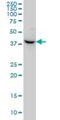 Nodal Growth Differentiation Factor antibody, H00004838-M03, Novus Biologicals, Western Blot image 