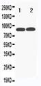 Transferrin Receptor 2 antibody, PA5-80115, Invitrogen Antibodies, Western Blot image 